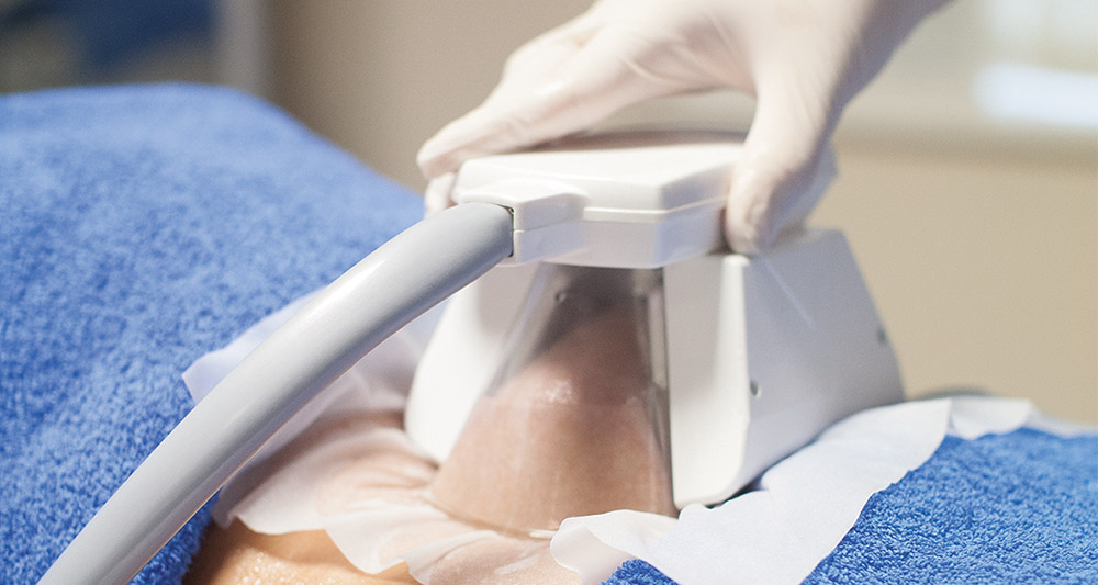 How Fat Freezing and HIFU Work Together? 2 Multiple Areas in One Session HIFU and Fat Freezing Suffolk