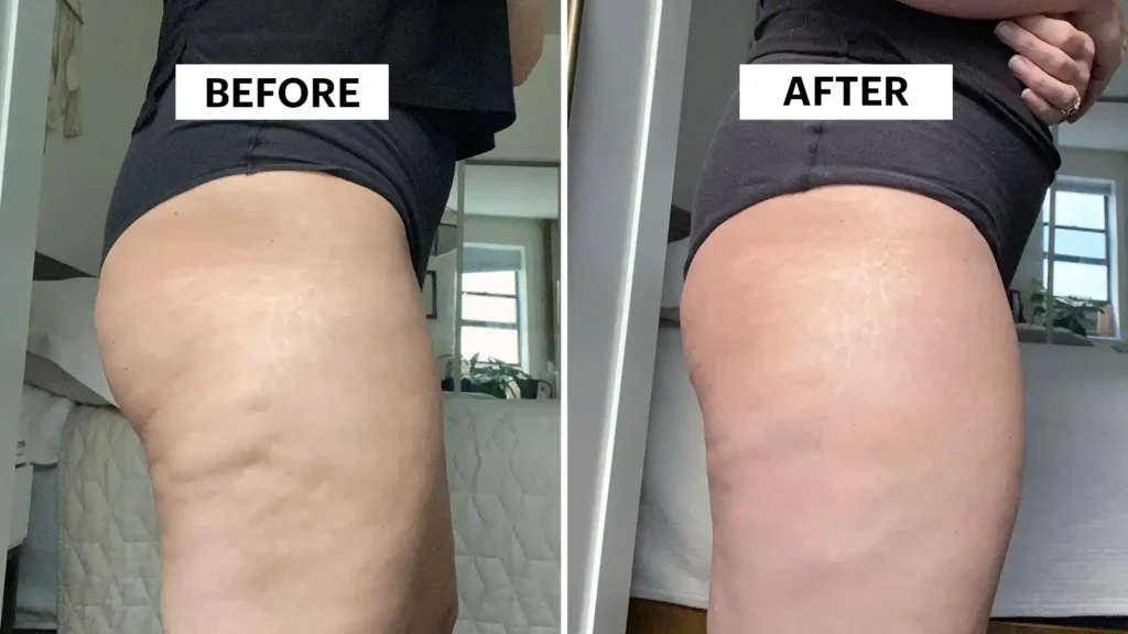 Do Toning Exercise Suffolk Really Tackle Cellulite?