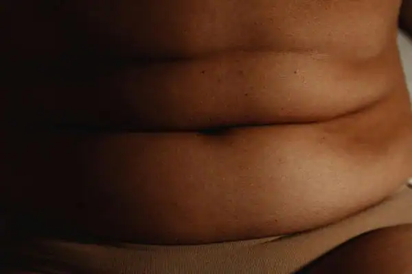 The Hidden Connection: How Stress Shapes Your Fitness and Body Composition 3 image of what stress can do on the stomach area and how Lipo 360 Suffolk can help to change your body shape.